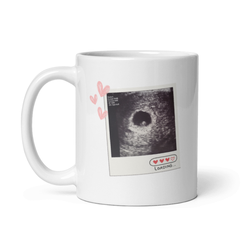 Seitenansicht einer weißen Ankündigungstasse mit Henkel links, einem Ultraschallbild im Polaroid-Stil und kleinen Herzen.
