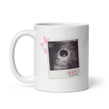 Seitenansicht einer weißen Ankündigungstasse mit Henkel links, einem Ultraschallbild im Polaroid-Stil und kleinen Herzen.