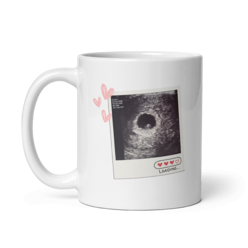 Seitenansicht einer weißen Tasse mit Henkel links, bedruckt mit einem Ultraschallbild im Polaroid-Rahmen, rosa Herzen und dem Schriftzug „Loading...“.
